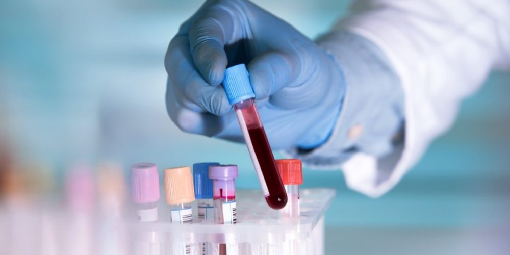 doctor-blood-test-tubes